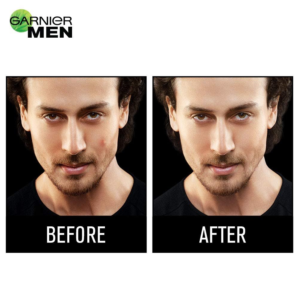 Garnier Men Acno Fight Cream - Before After Image